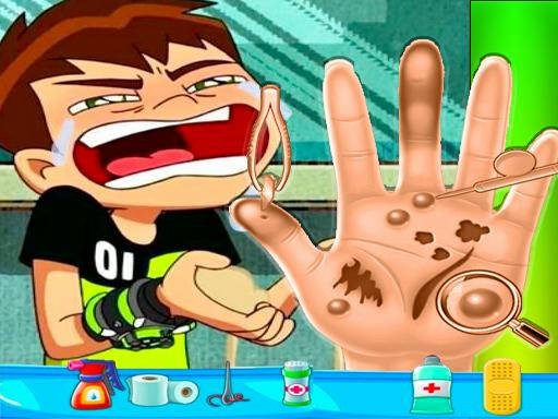 Play Ben10 Hand Doctor - Free Online Game